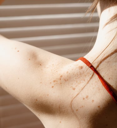 lesión cutánea verrugas puntos rubí lunares cicatrices láser de CO2 estética iMujer clinica tratar