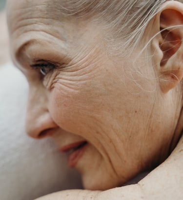aumento pómulos murcia rellenos botox acido hialuronico hilos tensores estética iMujer clinica