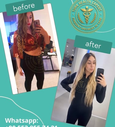 Galería de Fotos Antes y Después de Manga Gástrica