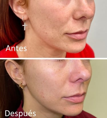 Produccion de colageno