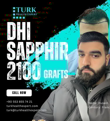 Résultat implant capillaire DHI Turquie avant/après - Restauration de la ligne frontale