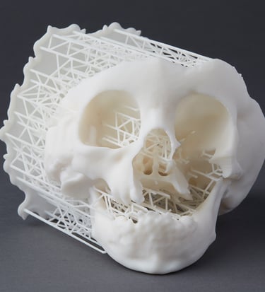 impresión 3d medica