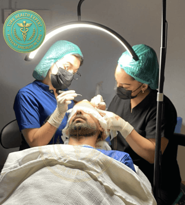 equipo medico implanta el pelo a un paciente del injerto capilar