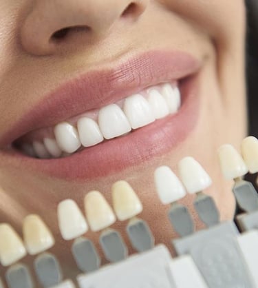 Tratamento de branqueamento dentário para dentes mais brancos e saudáveis - Setúbal