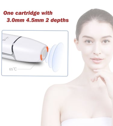 4D Radar carving treatment laser