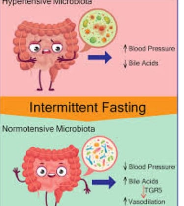 The Impact of Microbiome, Fasting, and Probiotics on Cancer (4)