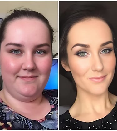 Wie funktionieren Ozem Patches Result One