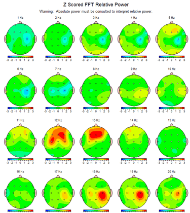 Mapping EEGQ