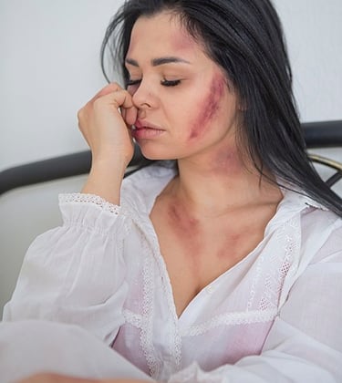 Une jeune femme a des ecchymoses sur le visage elle a les yeux fermés