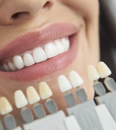 Branqueamento dentário profissional em Setúbal para um sorriso mais branco e brilhante.