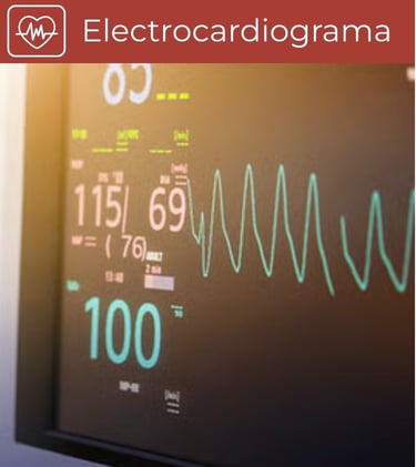 Electrocardiograma
