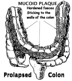 The Mucoid plaque that covers your large intestines