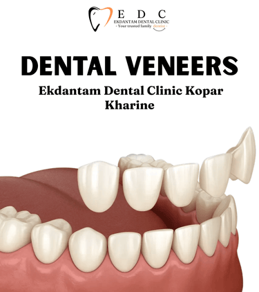 Veneers in Kopar Khairane | Ekdantam Dental Clinic kopar kharine