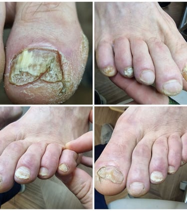 nagu grybelis pradžia 2023 gegužės 5 diena