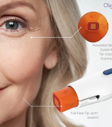 monopolar radiofrequency RF skin tightening