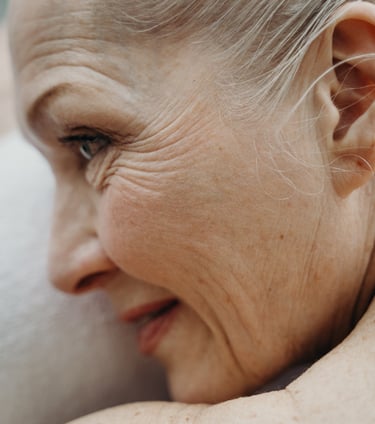 tratamientos para eliminar las arrugas en Murcia. Clinica Estética iMujer. Pilar Soriano Lucas Egea
