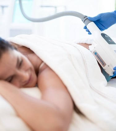 coolsculpting criolipolisis
