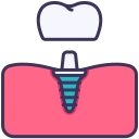 implante-dental-benfica