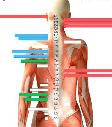 Before Insight neurological scan at Three Nails Chiropractic Franklin TN