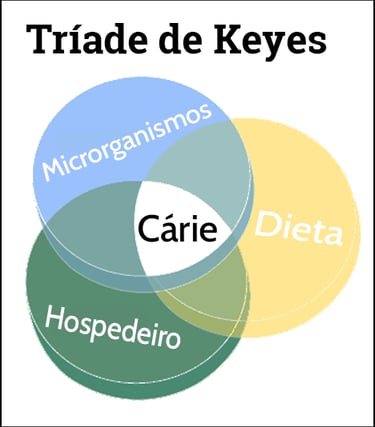 tríade de keyes, diagrama de newbrum etiologia da cárie resumo