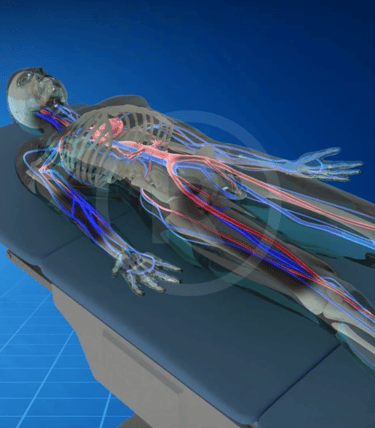 Stent Medical Animation