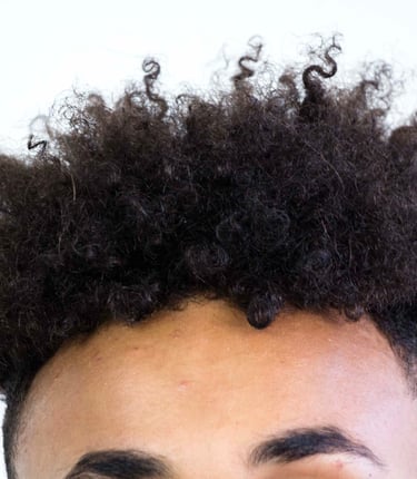 Top of the young men's forehead and top of his head with a spiky curly hairdo. 