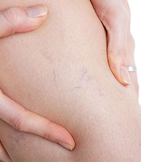 dottor Andrea Vercelli angiologo