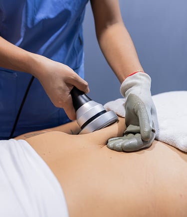 A person aplicate cavitation and radiofrequency