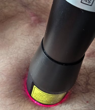 heart surgery recovery with LLLT