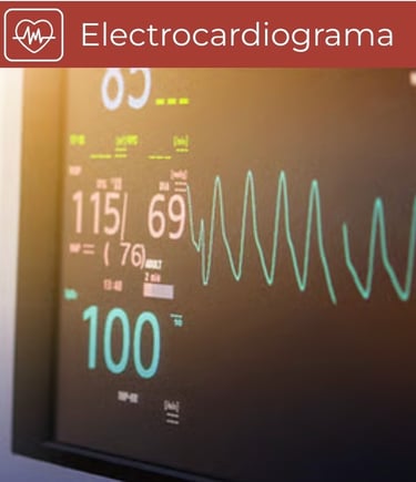 Electrocardiograma