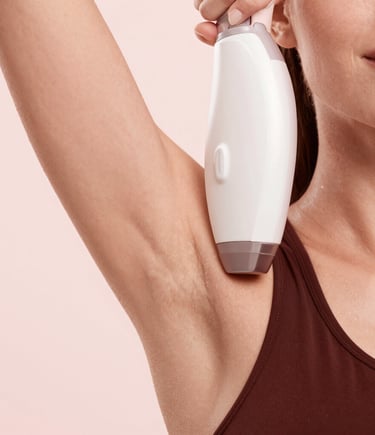 Close-up of a laser hair removal session in progress, highlighting precision and comfort.