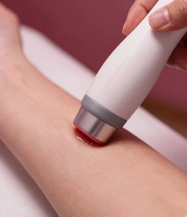 Close-up of a laser hair removal session in progress, highlighting precision and comfort.