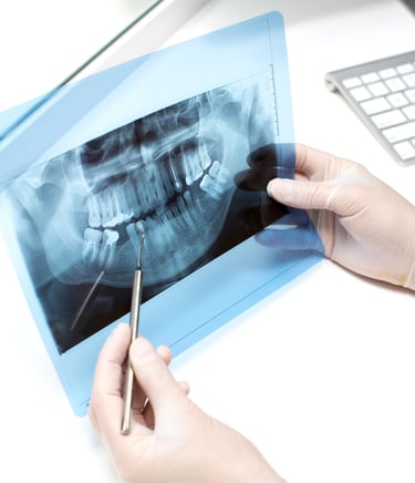 Endodontija Kanalų gydymas Palanga