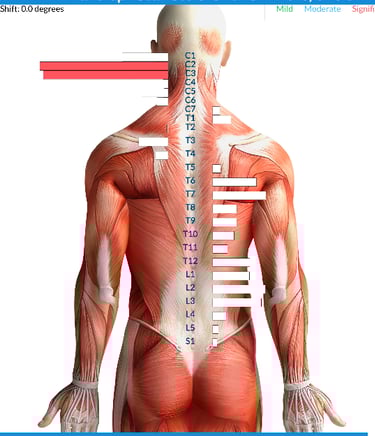 Vagus nerve stress from birth trauma causing tongue tie and latching issues