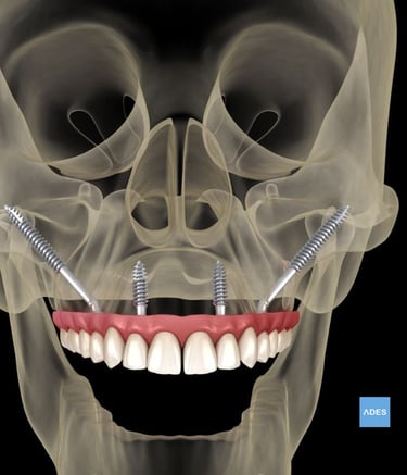 Diagnóstico dental en Clínica ADES Badajoz