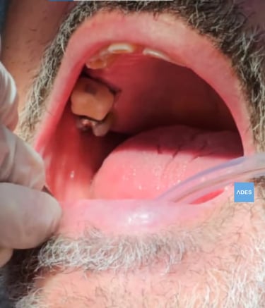 Diagnóstico odontológico en Badajoz
