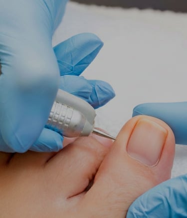 Professional nail technician using an electric drill for a medical pedicure treatment on a client.