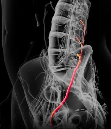 Stimulating the Femoral Nerve