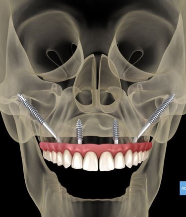 Diagnóstico dental en Clínica ADES Badajoz