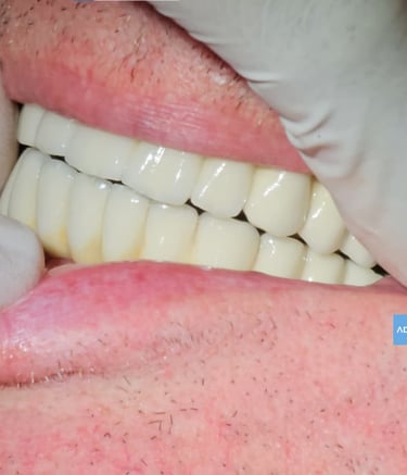 Dentista revisando dientes en Badajoz