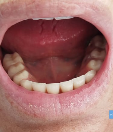 Paciente feliz con sonrisa blanca en Badajoz