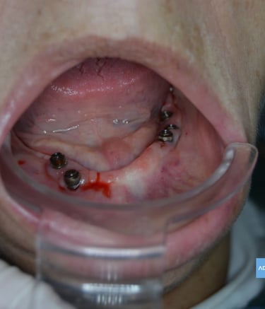 Clínica dental en Calle Castillo de Zafra, Badajoz