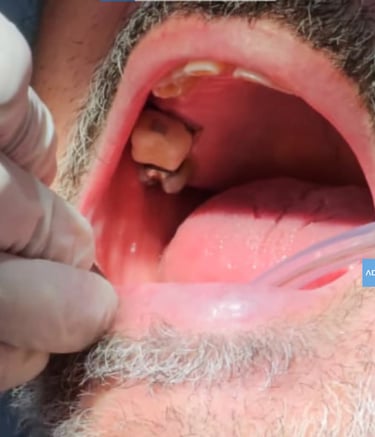 Diagnóstico odontológico en Badajoz