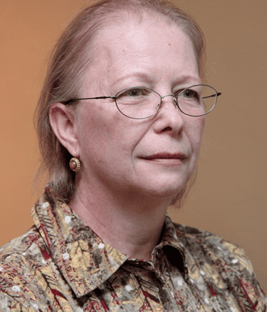 Before permanent non-surgical hair replacement – overall thinning hair showing scalp through the par