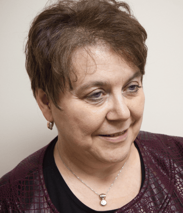 Before permanent non-surgical hair replacement – visible thinning and hair loss at the crown 