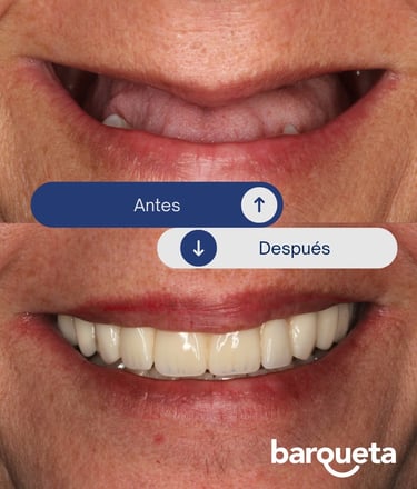 Paciente satisfecho tras un tratamiento de protesis dental en nuetsra clínica dental de sevilla