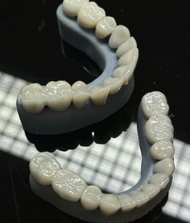 Dr Đorđe Pavlović stomatolog implantolog Srbija, keramicke krunice model