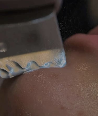 Limpeza de Pele em BH