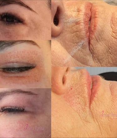 Jato de Plasma em BH