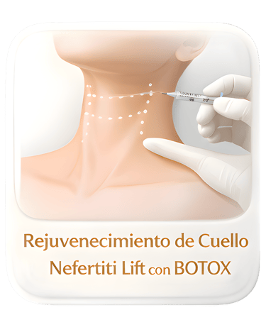 Nefertiti Lift neck rejuvenation treatment using Botox injections for jawline tightening.